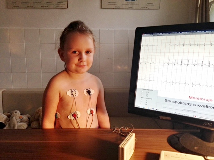 Holterovo EKG monitorovanie